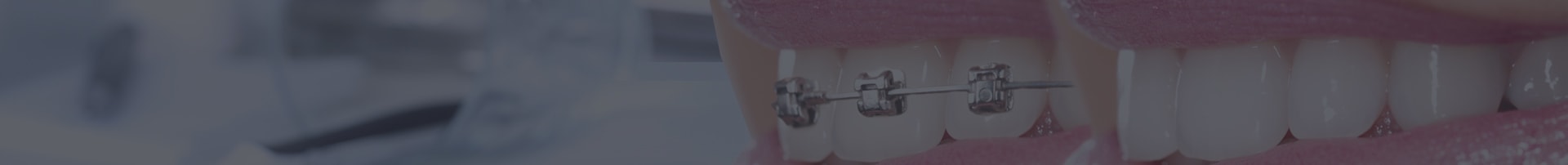 Banner ortodoncja